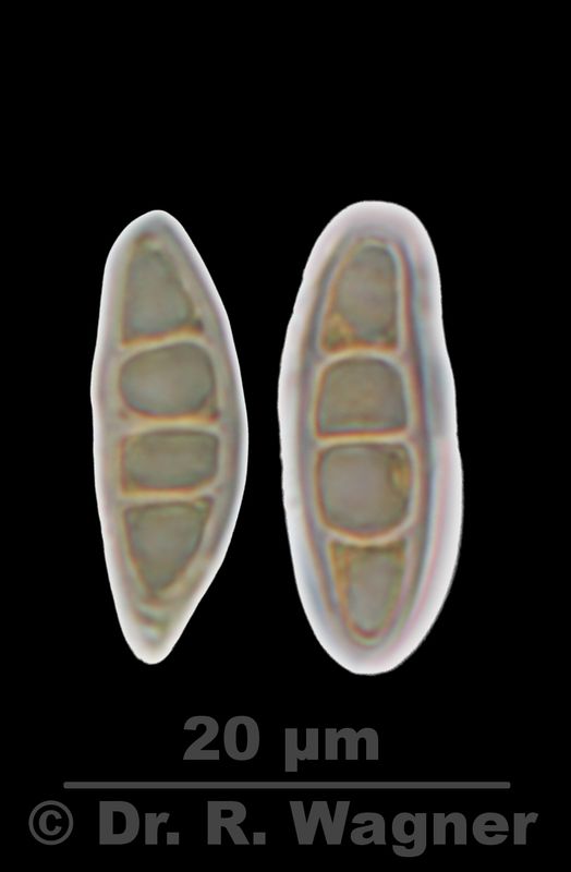 Nephroma laevigatum #28917
