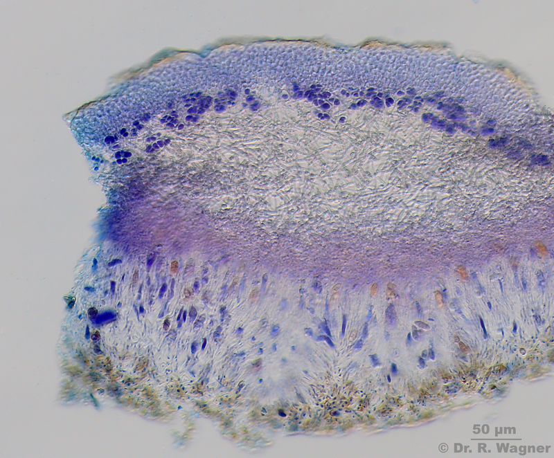 Nephroma laevigatum #28916