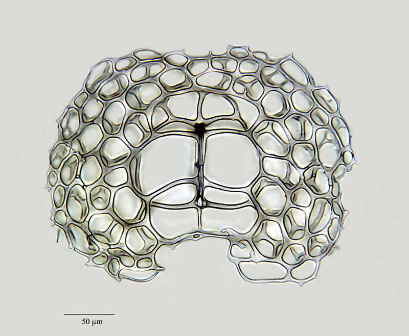 Nephrospyris renilla Haeckel #45107