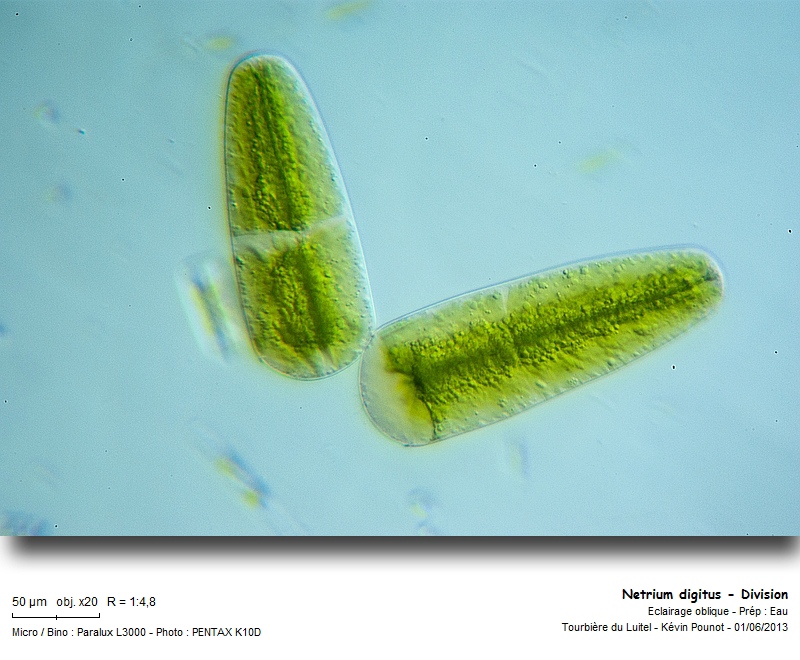 Netrium digitus (Brébisson ex Ralfs) Itzigsohn & Rothe #31562