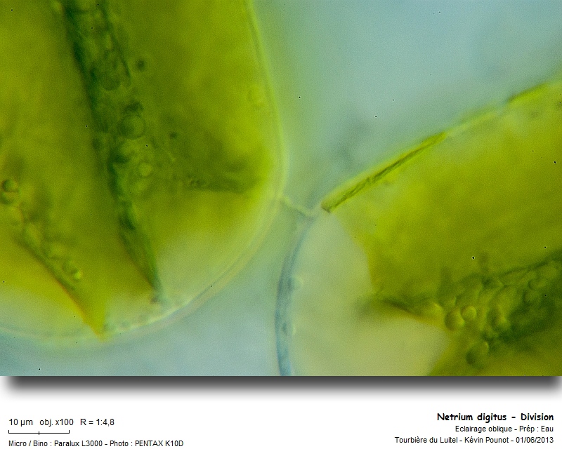 Netrium digitus (Brébisson ex Ralfs) Itzigsohn & Rothe #31563
