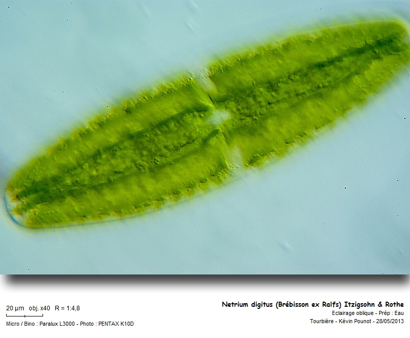 Netrium digitus (Brébisson ex Ralfs) Itzigsohn & Rothe #31457