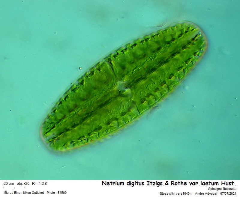 Netrium digitus Itzigs. et Roth var. latum Hust. #67297