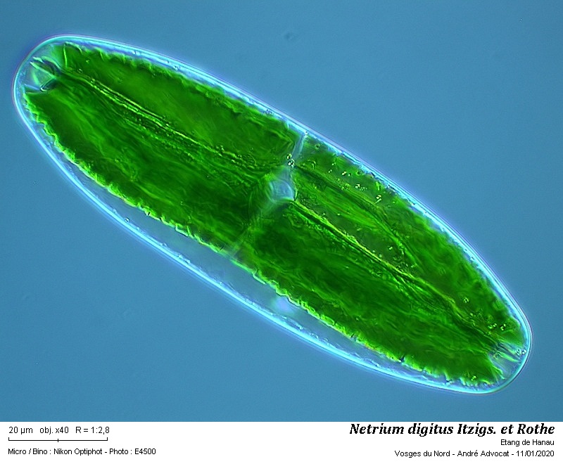 Netrium digitus Itzigs.et Rothe #61508
