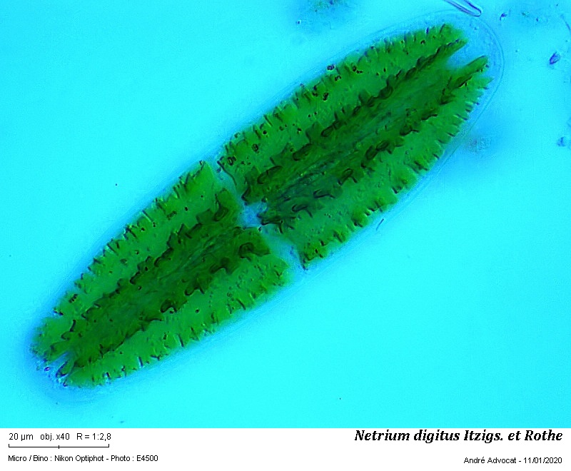 Netrium digitus Itzigs.et Rothe #61511