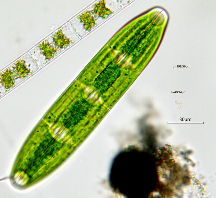 Netrium interruptum #75609