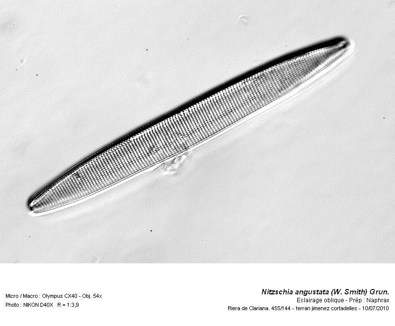 Nitzschia angustata (W. Smith) Grun. #17137