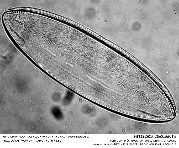 Nitzschia circumsuta #33153