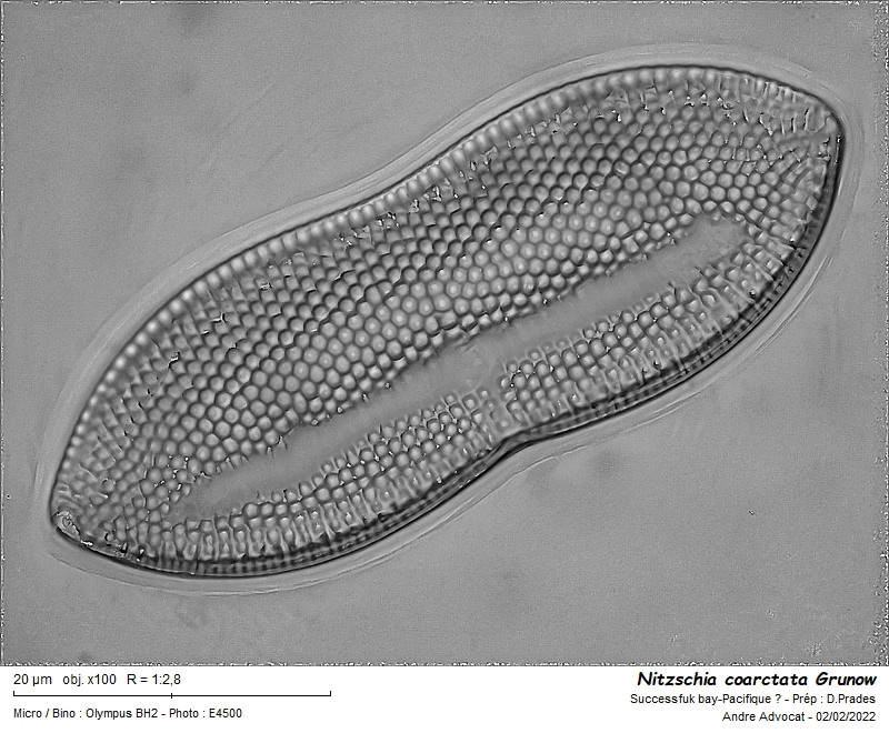 Nitzschia coarctata Grunow #69301