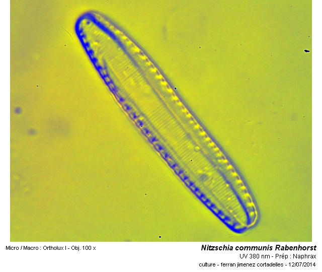 Nitzschia communis Rabenhorst #38191