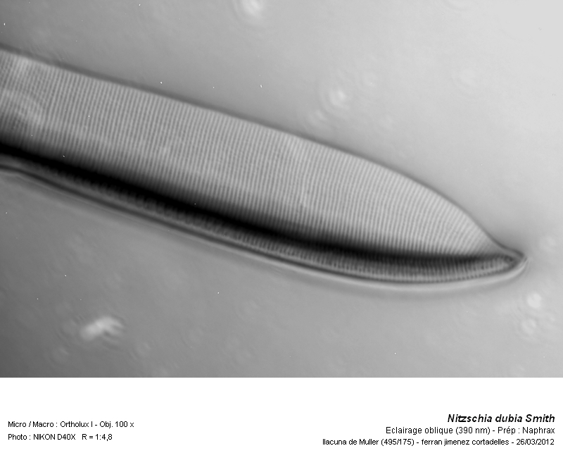 Nitzschia dubia Smith #26229