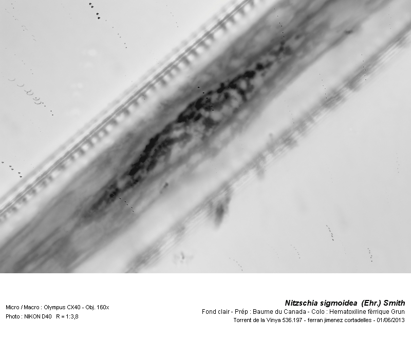 Nitzschia sigmoidea (Ehr.) Smith. (Chromosomes) #31583