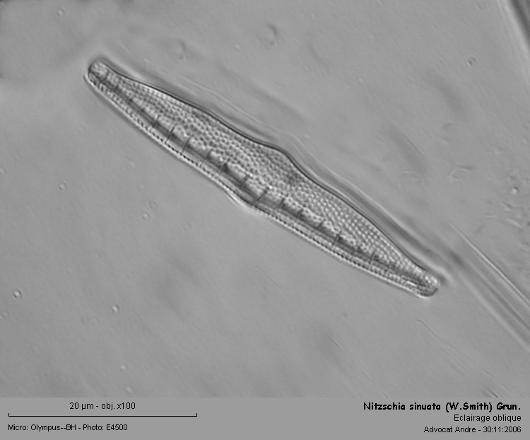 Nitzschia sinuata (W.Smith) Grun. #2161