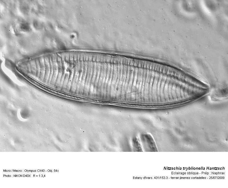 Nitzschia tryblionella Hantzsch #13744