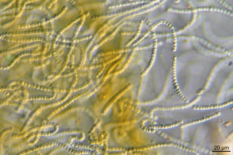 Nostoc cf. parmelioides (Kütz., 1843) Bornet & #41880