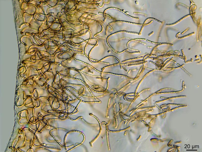 Nostoc cf. parmelioides (Kütz., 1843) Bornet & #41876