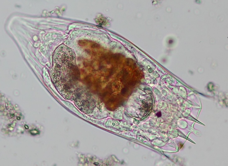 Notholca acuminata #57759