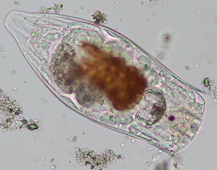 Notholca acuminata #57758