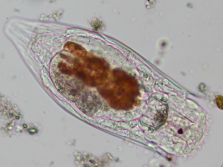 Notholca acuminata #57760