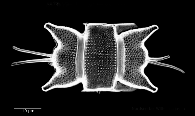 Odontella aurita #60496