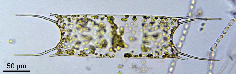 Odontella sinensis Greville #36980