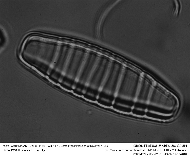 ODONTIDIUM MRINUM Grun #31734