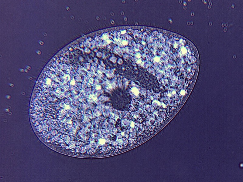 Ophryoglena atra Lieb #22378