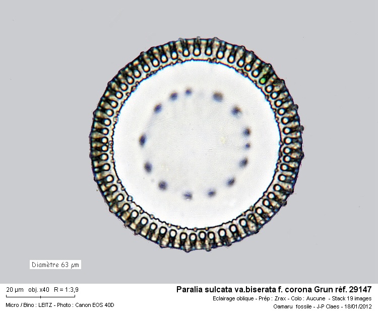 Paralia sulcata var. Biserata f. corona Grunow #25714