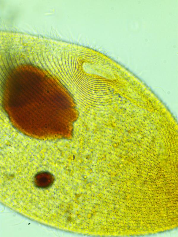 Paramecium caudatum (imprégnation argentique) #35098