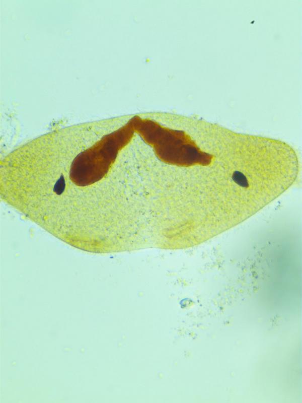 Paramecium caudatum (imprégnation argentique) #35099