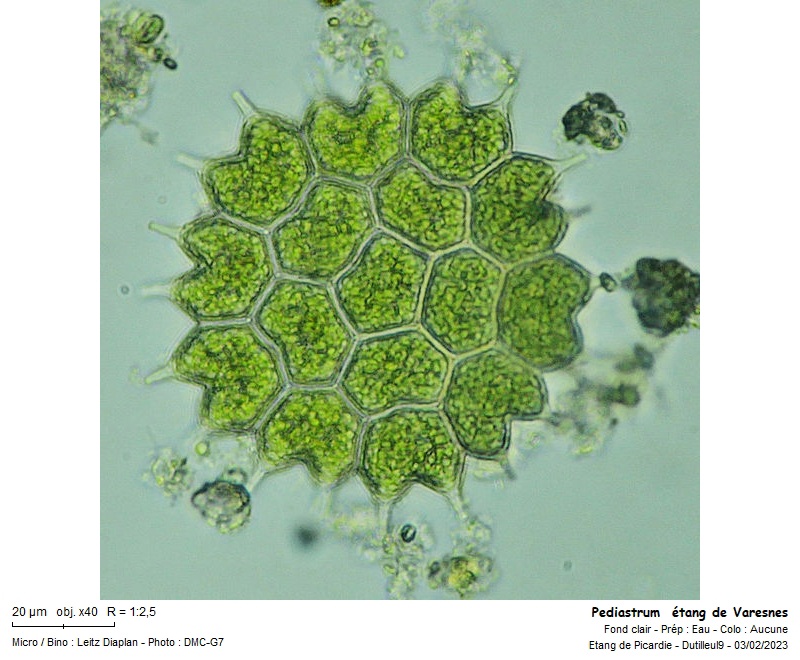 Pediastrum boryanum #73593