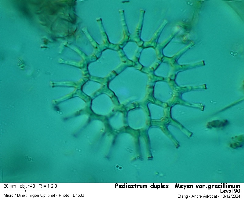 Pediastrum duplex Meyen var. gracillimum #81034