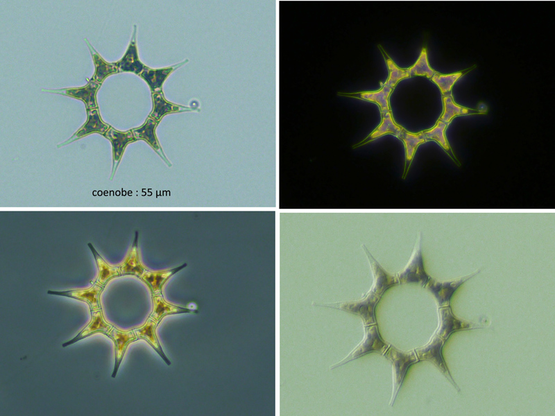 Pediastrum simplex MEYEN, 1829 #67791