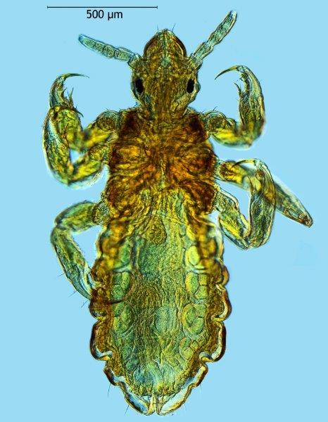 Pediculus humanus capitis #67863