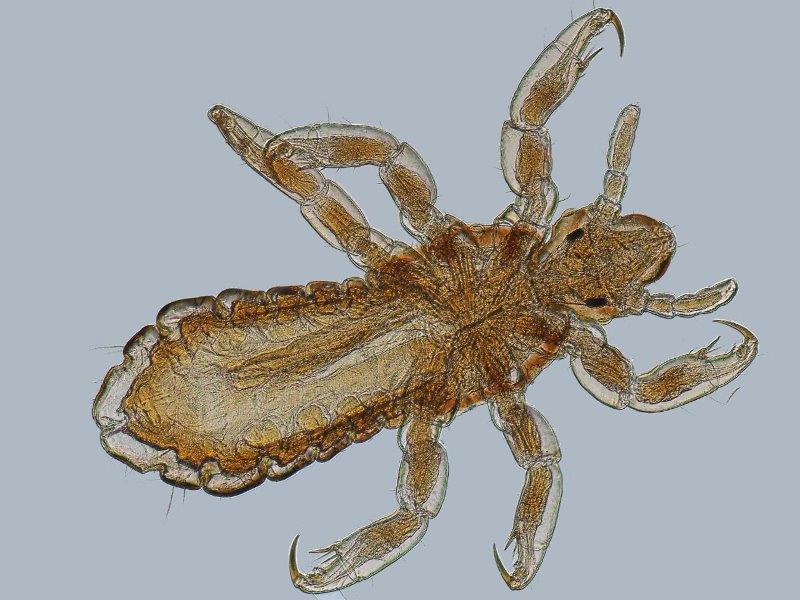 Pediculus humanus capitis #67873