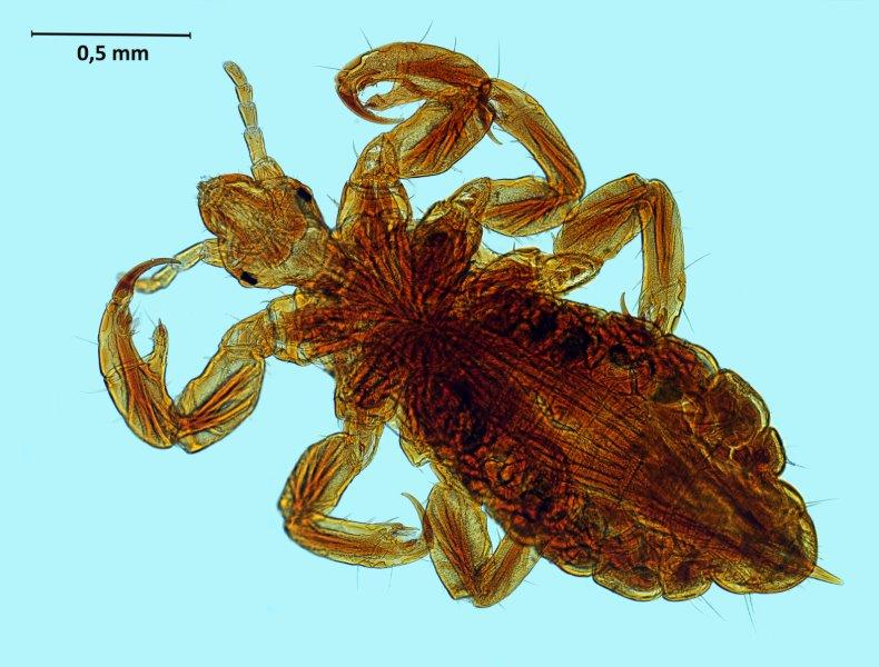Pediculus humanus capitis #68010