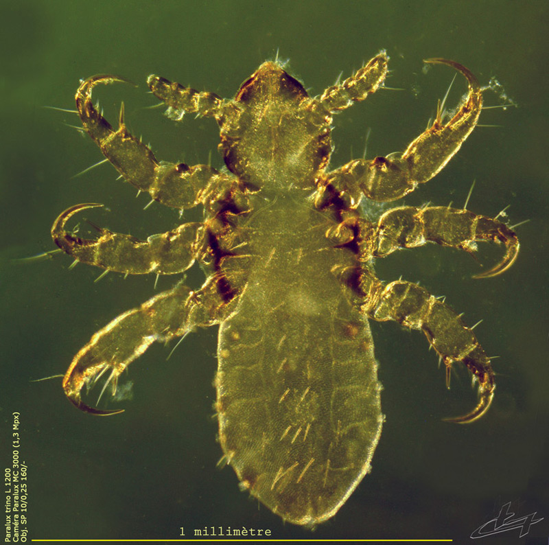 Pediculus humanus capitis #63763