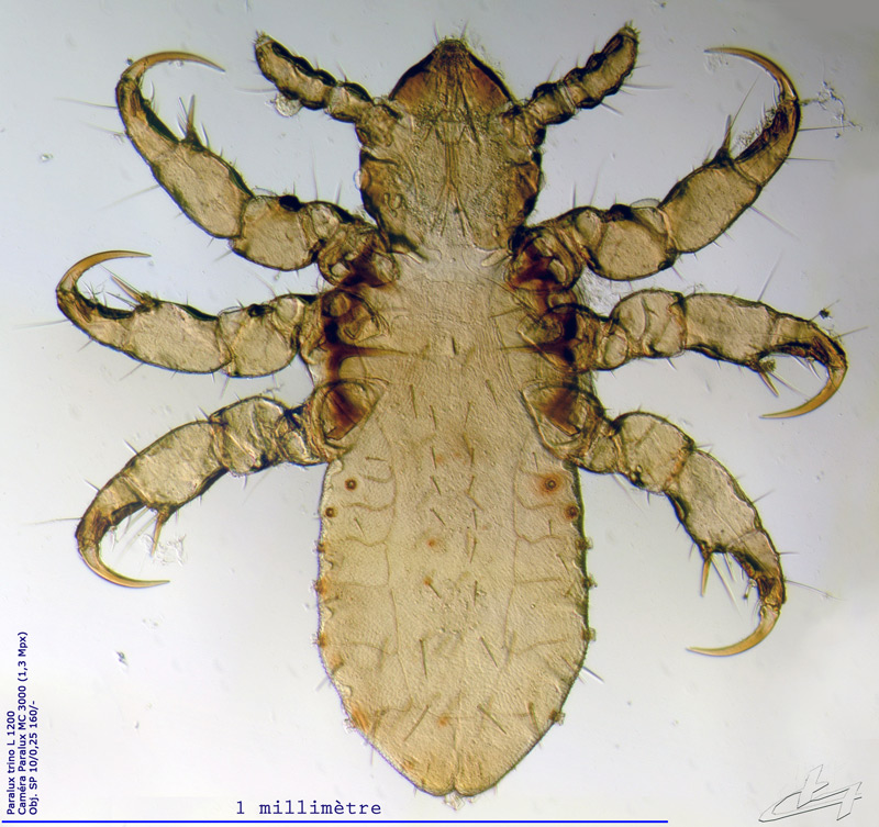 Pediculus humanus capitis #63761