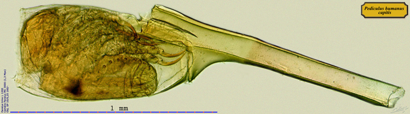 Pediculus humanus capitis #63762