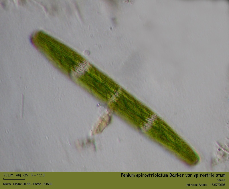 Penium spirostriolatum Barker var spirostriolatum #1573
