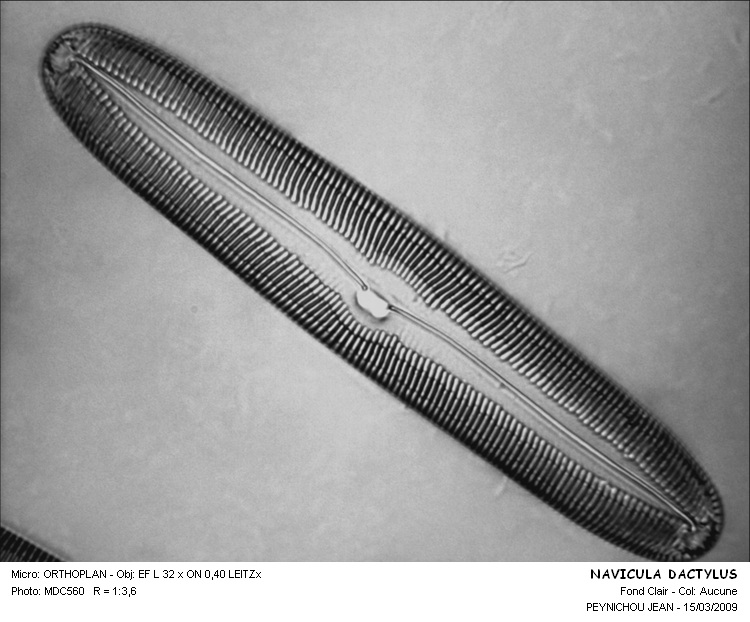 Pinnularia  dactylus #31925