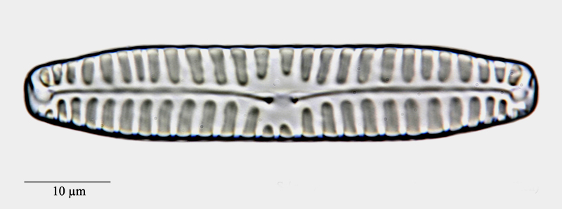 Pinnularia borealis #71773