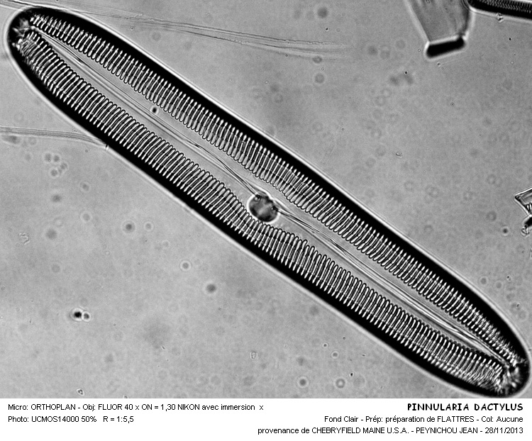 PINNULARIA DACTYLUS #34960