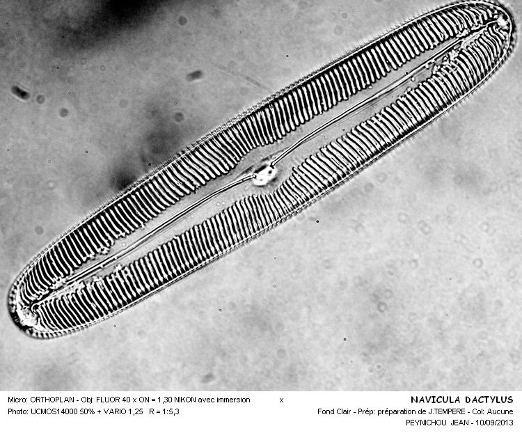 PINNULARIA DACTYLUS #33723