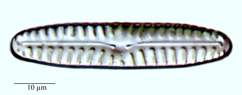 Pinnularia lata #75749