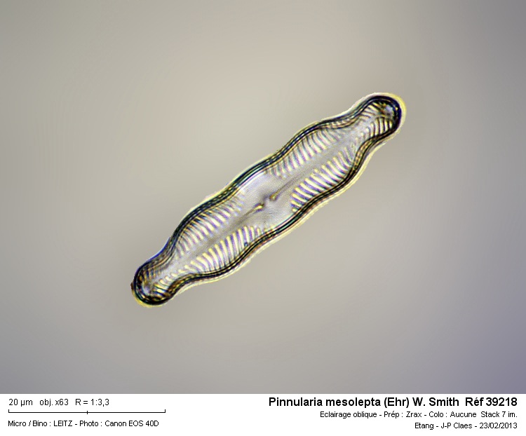 Pinnularia mesolepta #29949