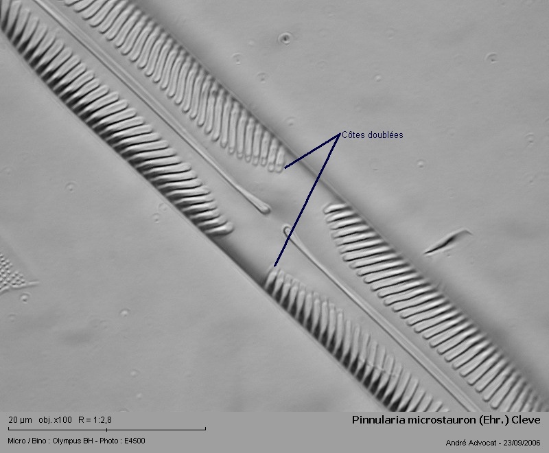 Pinnularia microstauron (Ehr.) Cleve 1891 #6327