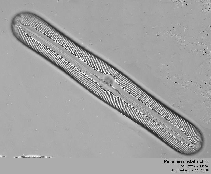Pinnularia nobilis (Ehrenberg) Ehrenberg #6355