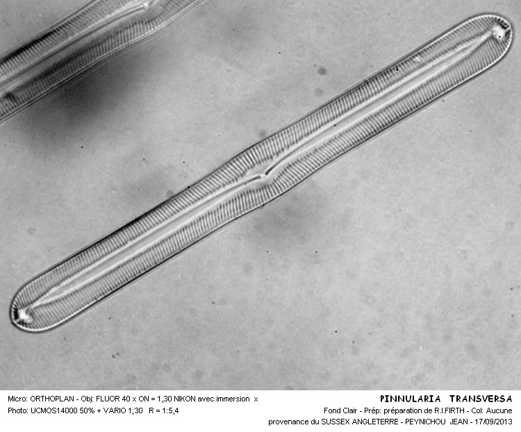 PINNULARIA TRANSVERSA  A #33832
