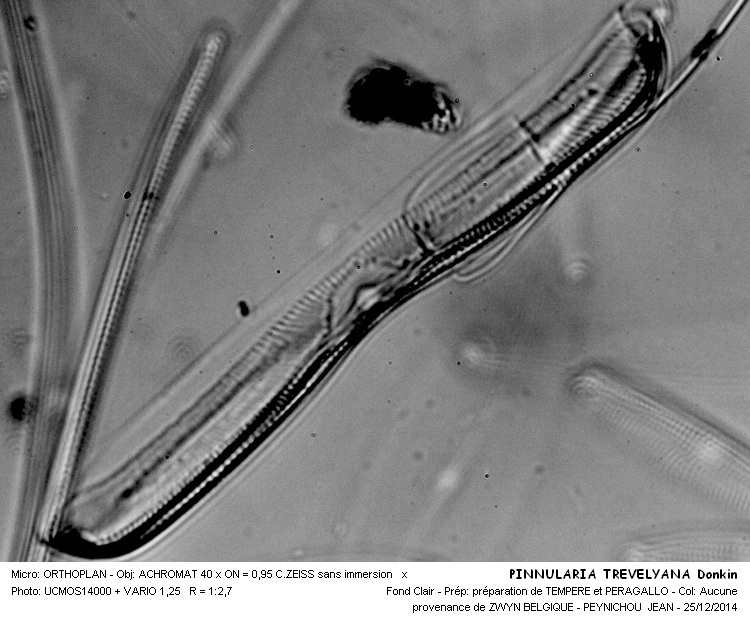 PINNULARIA TREVELYANA #40191
